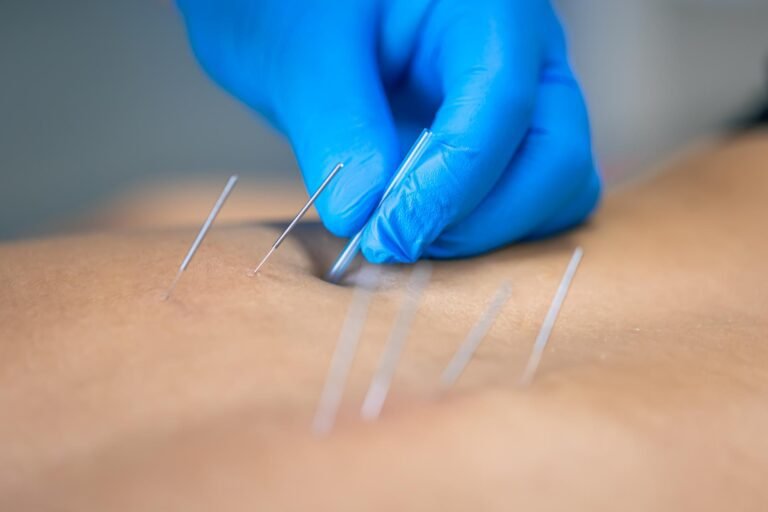close-up-needle-hands-physiotherapist-doing-dry-needling
